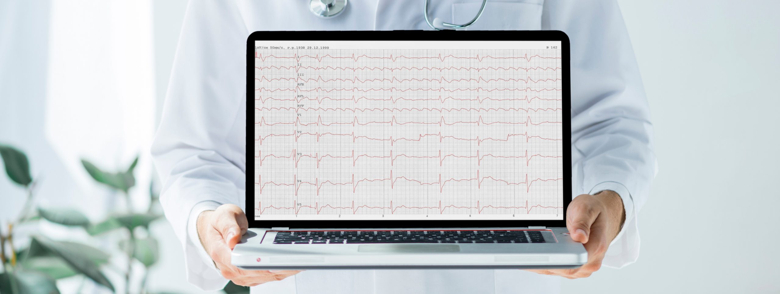 Computer Vision in Healthcare: ECG digitalization use case
