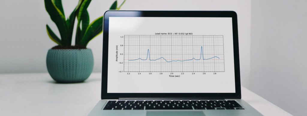 HRV Analysis and Atrial Fibrillation Detection using Machine Learning