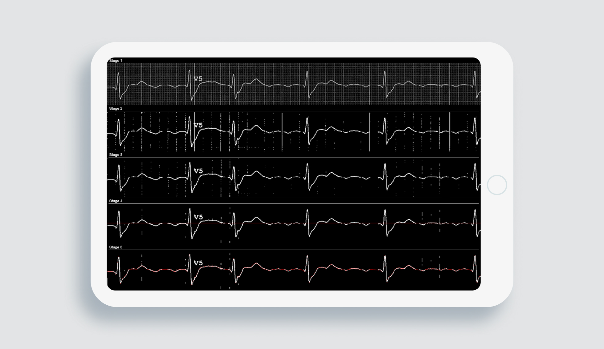 ECG digitization using CV