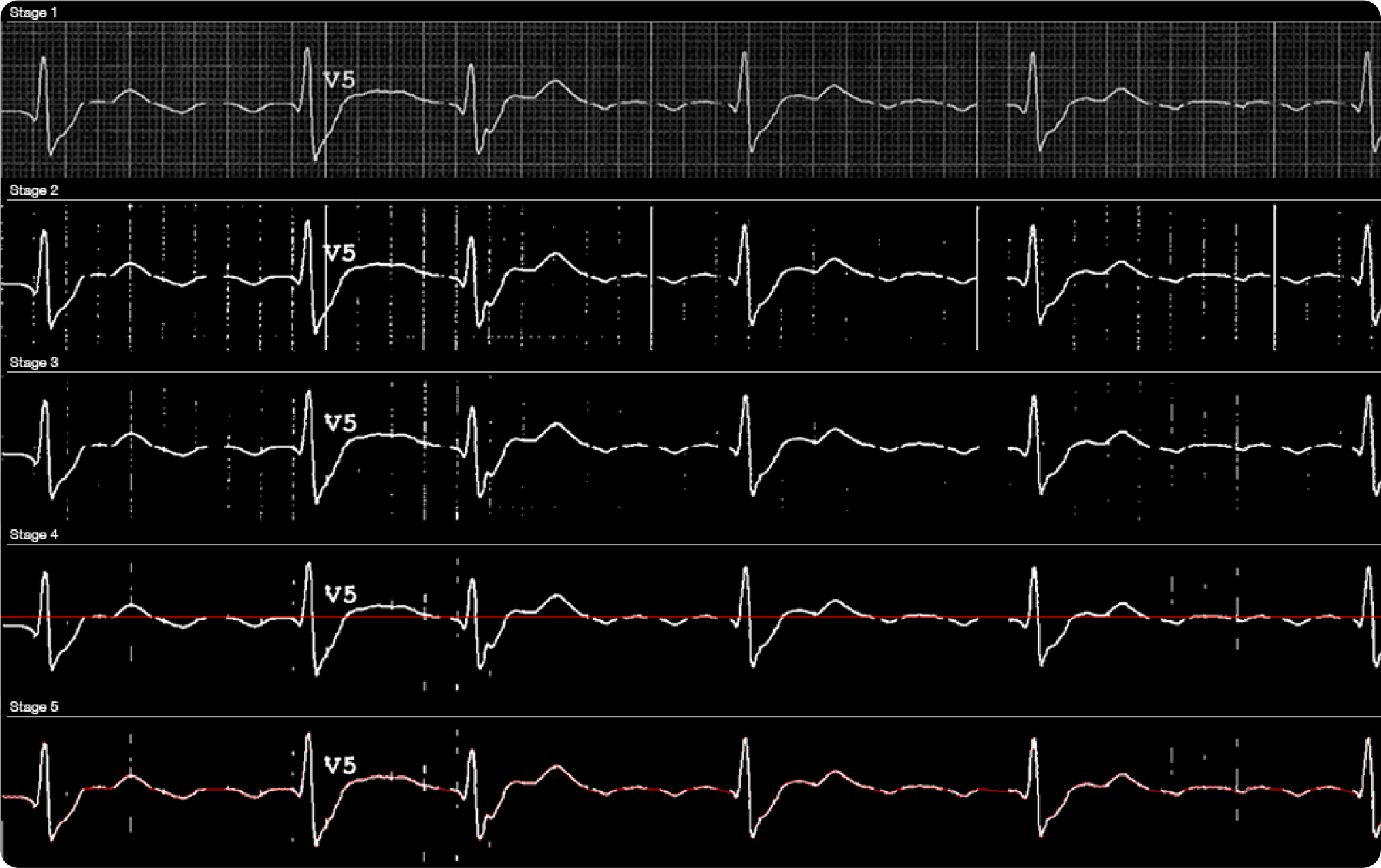 Explore the Success Story of ECG Digitization